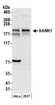 Western Blot: ANKRD15 Antibody [NBP1-03345]