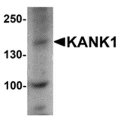 Western Blot: ANKRD15 AntibodyBSA Free [NBP2-81953]