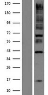 Western Blot: ANKRD15 Overexpression Lysate [NBP2-05271]