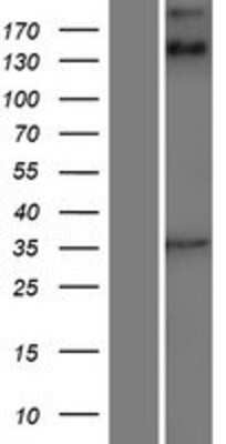 Western Blot: ANKRD15 Overexpression Lysate [NBP2-10297]