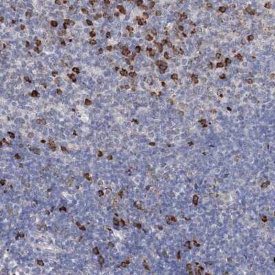 Immunohistochemistry: ANKRD16 Antibody [NBP2-38372]