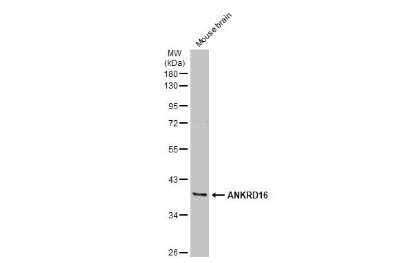 Western Blot: ANKRD16 Antibody [NBP3-13416]