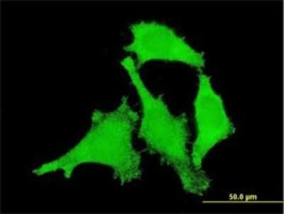 Immunocytochemistry/ Immunofluorescence: ANKRD17 Antibody (1D12) [H00026057-M03]