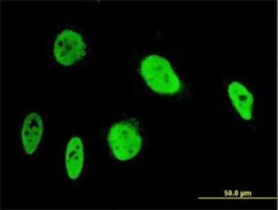 Immunocytochemistry/ Immunofluorescence: ANKRD17 Antibody (2B8) [H00026057-M02]