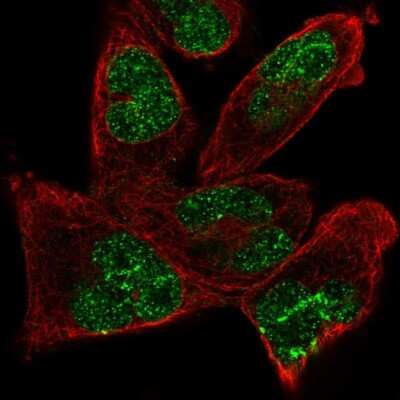 Immunocytochemistry/ Immunofluorescence: ANKRD17 Antibody [NBP2-57107]