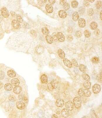 Immunohistochemistry-Paraffin: ANKRD17 Antibody [NB100-86996]