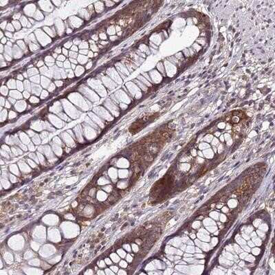 Immunohistochemistry-Paraffin: ANKRD17 Antibody [NBP1-91668]