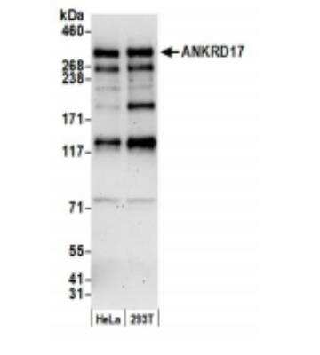 Western Blot: ANKRD17 Antibody [NB100-86995]