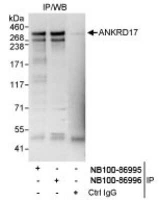 Immunoprecipitation: ANKRD17 Antibody [NB100-86996]