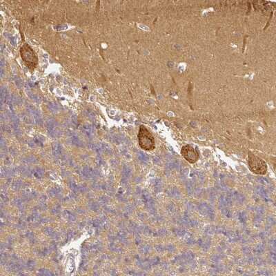 Immunohistochemistry: ANKRD18A Antibody [NBP2-48843]