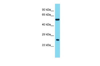 Western Blot: ANKRD18A Antibody [NBP2-86999]