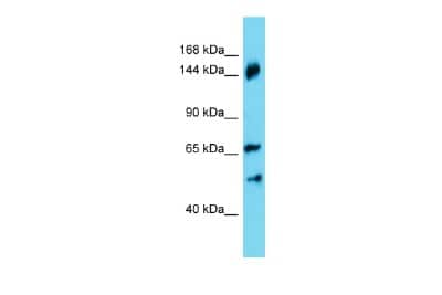 Western Blot: ANKRD18B Antibody [NBP3-09684]