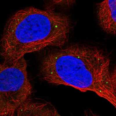 Immunocytochemistry/ Immunofluorescence: ANKRD2 Antibody [NBP1-91670]