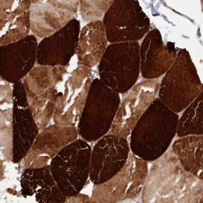 Immunohistochemistry-Paraffin: ANKRD2 Antibody [NBP1-91669]