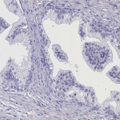 Immunohistochemistry-Paraffin: ANKRD2 Antibody [NBP1-91669]