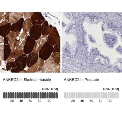 Immunohistochemistry-Paraffin: ANKRD2 Antibody [NBP1-91669]