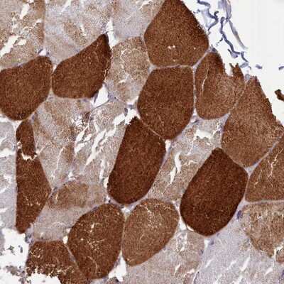 Immunohistochemistry-Paraffin: ANKRD2 Antibody [NBP1-91670]