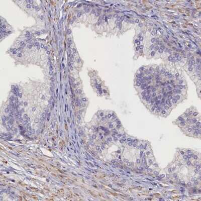 Immunohistochemistry-Paraffin: ANKRD2 Antibody [NBP1-91670]