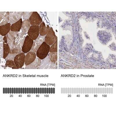 Immunohistochemistry-Paraffin: ANKRD2 Antibody [NBP1-91670]