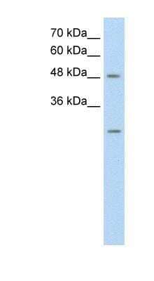 Western Blot: ANKRD2 Antibody [NBP1-56443]