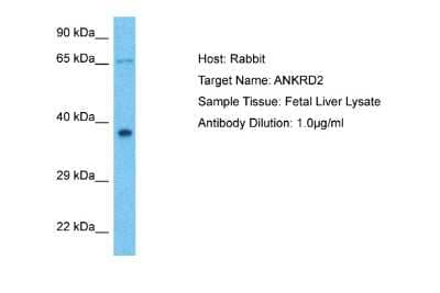 Western Blot: ANKRD2 Antibody [NBP2-87001]