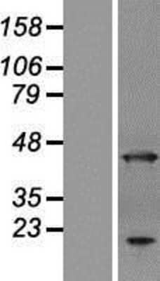 Western Blot: ANKRD2 Overexpression Lysate [NBL1-07535]