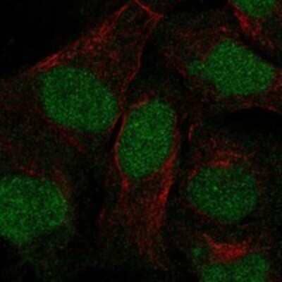 Immunocytochemistry/ Immunofluorescence: ANKRD20A3 Antibody [NBP3-17149]