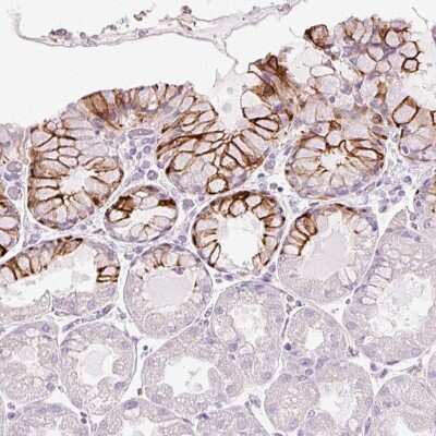 Immunohistochemistry-Paraffin: ANKRD20A4 Antibody [NBP2-33628]