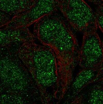 Immunocytochemistry/ Immunofluorescence: ANKRD22 Antibody [NBP1-81167]