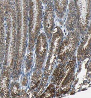 Immunohistochemistry-Paraffin: ANKRD22 Antibody [NBP1-81167]