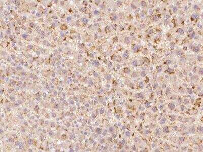 Immunohistochemistry-Paraffin: ANKRD22 Antibody [NBP3-06360]