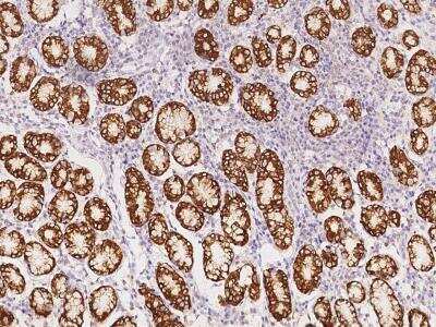 Immunohistochemistry-Paraffin: ANKRD22 Antibody [NBP3-06360]