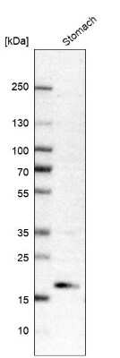 Western Blot: ANKRD22 Antibody [NBP1-81167]