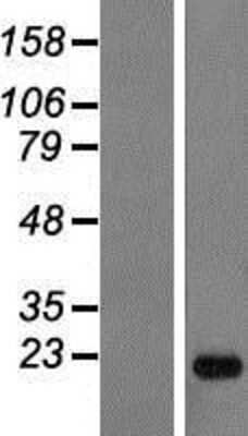 Western Blot: ANKRD22 Overexpression Lysate [NBP2-05557]