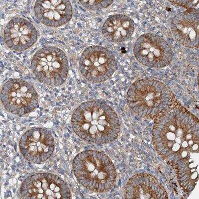 Immunohistochemistry-Paraffin: ANKRD26 Antibody [NBP1-82936]