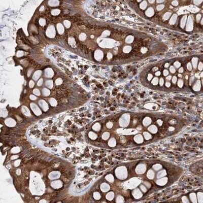 Immunohistochemistry-Paraffin: ANKRD26 Antibody [NBP1-82937]