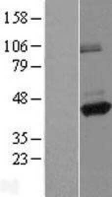 Western Blot: ANKRD26P1 Overexpression Lysate [NBL1-10768]