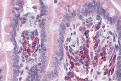 Immunohistochemistry: ANKRD27 Antibody - BSA Free [NBP2-82068]