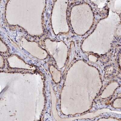 Immunohistochemistry-Paraffin: ANKRD27 Antibody [NBP1-85111]