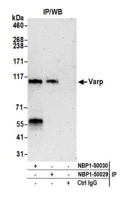 Immunoprecipitation: ANKRD27 Antibody [NBP1-50029]