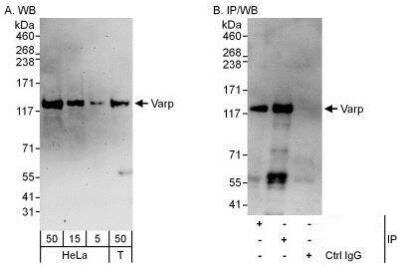 Western Blot: ANKRD27 Antibody [NBP1-50030]