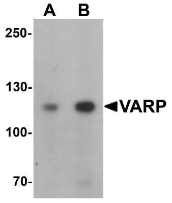 Western Blot: ANKRD27 AntibodyBSA Free [NBP2-82072]