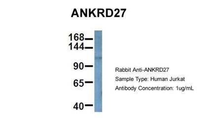 Western Blot: ANKRD27 Antibody [NBP2-87002]