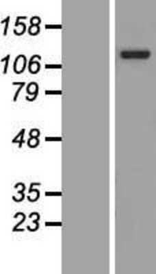 Western Blot: ANKRD27 Overexpression Lysate [NBL1-07537]