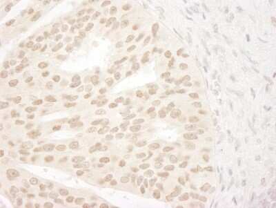 Immunohistochemistry: ANKRD28 Antibody [NB100-41419]