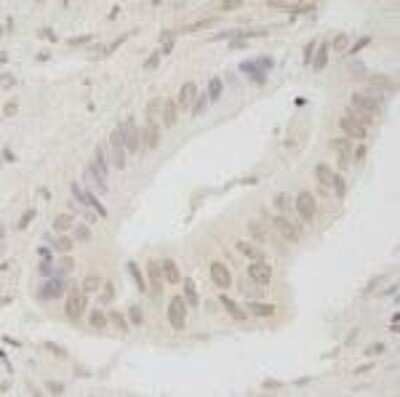 Immunohistochemistry-Paraffin: ANKRD28 Antibody [NB100-41419]