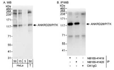 Western Blot: ANKRD28 Antibody [NB100-41419]