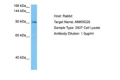 Western Blot: ANKRD28 Antibody [NBP2-83933]