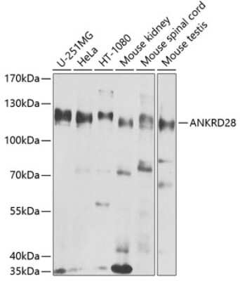 Western Blot: ANKRD28 AntibodyBSA Free [NBP2-92251]