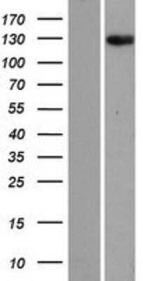 Western Blot: ANKRD28 Overexpression Lysate [NBP2-07201]